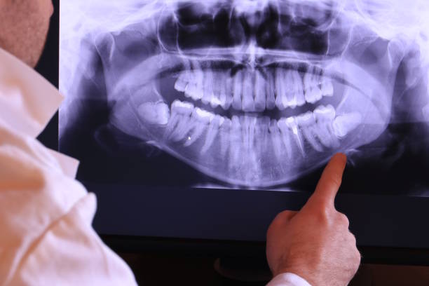 Best Emergency Dentist for Knocked-Out Tooth in Black Rock, NM